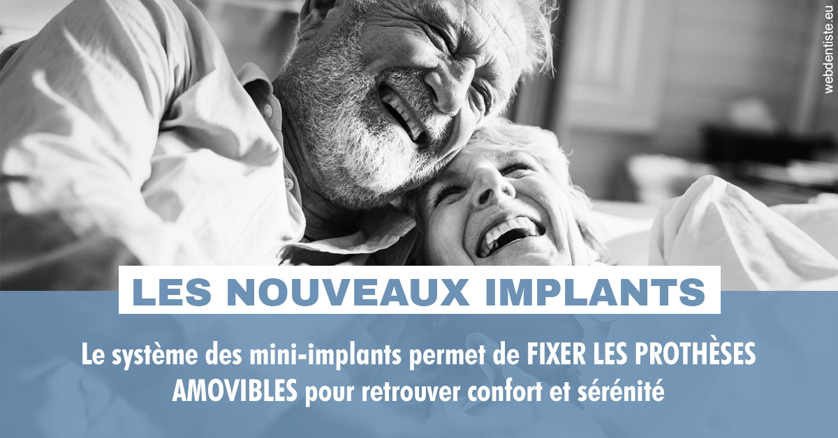 https://dr-membrado-daniel.chirurgiens-dentistes.fr/Les nouveaux implants 2