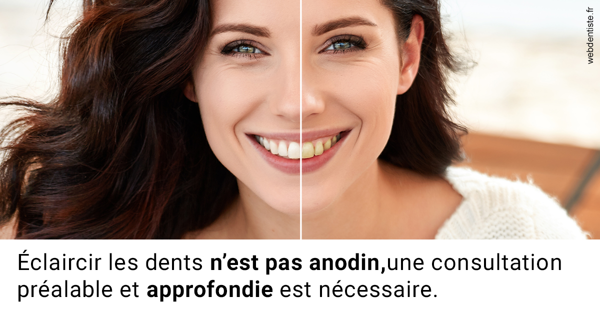 https://dr-membrado-daniel.chirurgiens-dentistes.fr/Le blanchiment 2