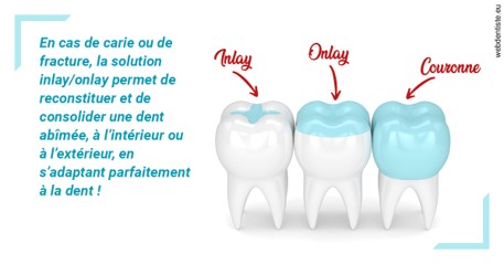 https://dr-membrado-daniel.chirurgiens-dentistes.fr/L'INLAY ou l'ONLAY