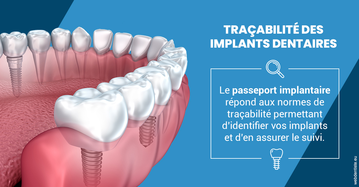 https://dr-membrado-daniel.chirurgiens-dentistes.fr/T2 2023 - Traçabilité des implants 1