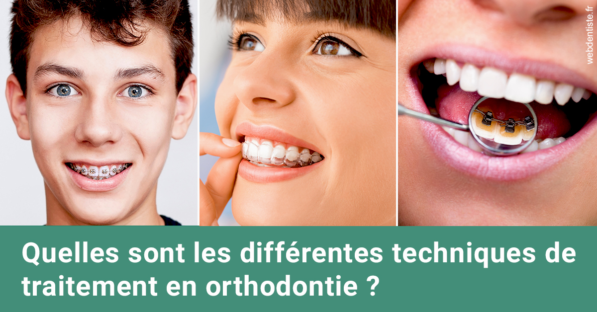 https://dr-membrado-daniel.chirurgiens-dentistes.fr/Les différentes techniques de traitement 2