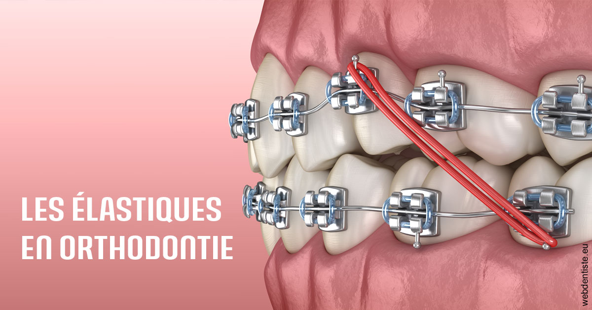 https://dr-membrado-daniel.chirurgiens-dentistes.fr/Elastiques orthodontie 2