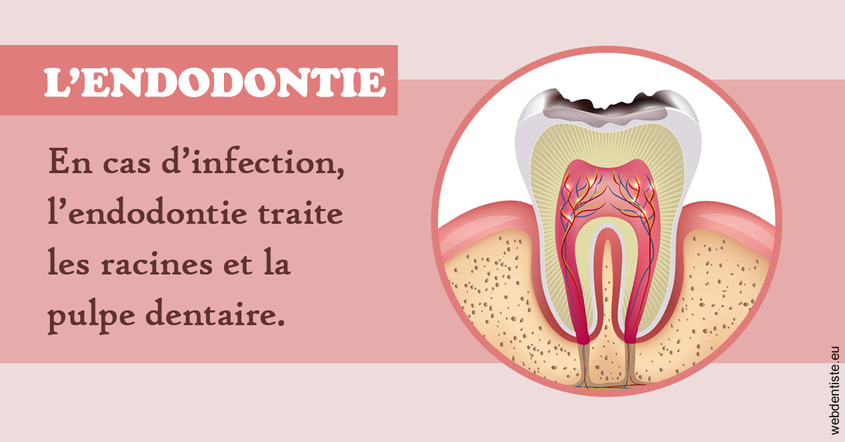 https://dr-membrado-daniel.chirurgiens-dentistes.fr/L'endodontie 2