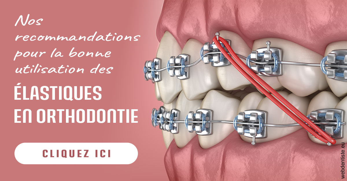 https://dr-membrado-daniel.chirurgiens-dentistes.fr/Elastiques orthodontie 2